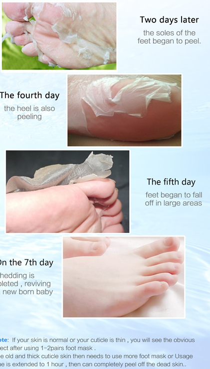 This Exfoliating Foot Peeling for Pedicure Sock Mask removes dead skin, detoxes, smooth calluses. The mask contains a gentle formula to soften and effectively moisturize your feet. The lactic acid will replenish moisture levels and is suitable for all skin types, especially coarse and dull skin, dry dead skin, and cracked heels. Net Weight: 40 g Size: One size fits all Quantity 3 pairs=6 pieces 