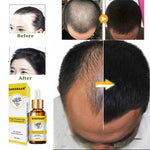 Saksraar Ginger Prevent Hair Loss Essential Oil is composed with traditional Chinese herbs to soften the hair strand and strengthen the scalp, resulting in a reduction of hair loss after continued use. Formulated with herbs such as ginseng extract, ginger extract and fleeceflower root, this serum will result in treated scalp and thicker hair. Recommended use for a minimum of two months for best results. Ingredient: Traditional Chinese medicine composition