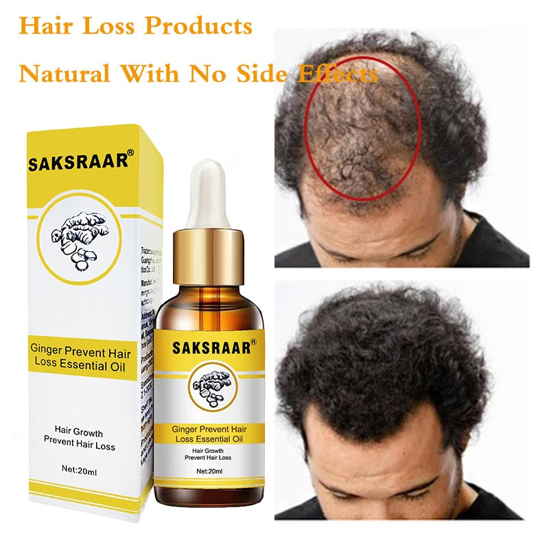 Saksraar Ginger Prevent Hair Loss Essential Oil is composed with traditional Chinese herbs to soften the hair strand and strengthen the scalp, resulting in a reduction of hair loss after continued use. Formulated with herbs such as ginseng extract, ginger extract and fleeceflower root, this serum will result in treated scalp and thicker hair. Recommended use for a minimum of two months for best results. Ingredient: Traditional Chinese medicine composition